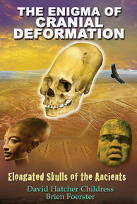 The Enigma of Cranial Deformation EBOOK